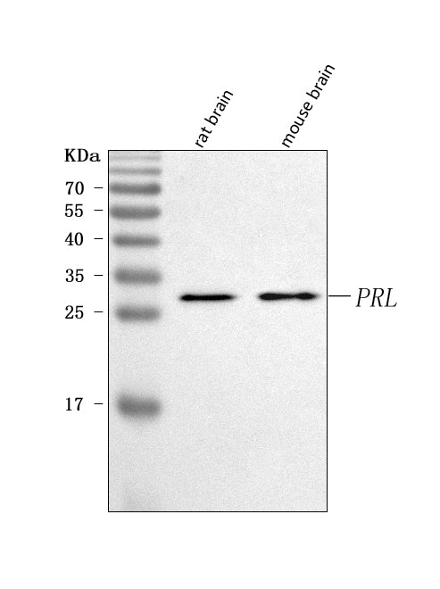 Anti-Prolactin/PRL Antibody Picoband® Boster Bio