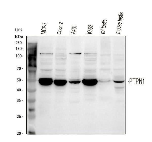 Anti-PTP1B/PTPN1 Antibody Picoband® Boster Bio