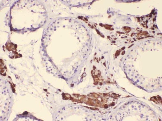 Anti-Cytochrome P450 17A1/CYP17A1 Antibody Picoband® Boster Bio