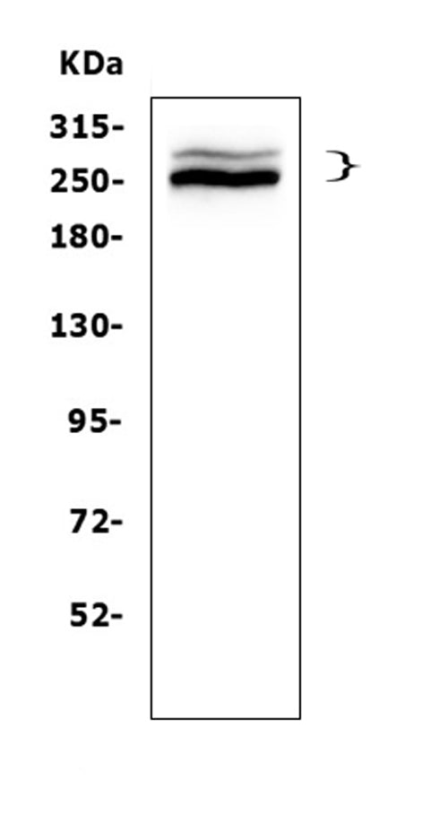 Anti-Desmoplakin/DSP Antibody Picoband® Boster Bio