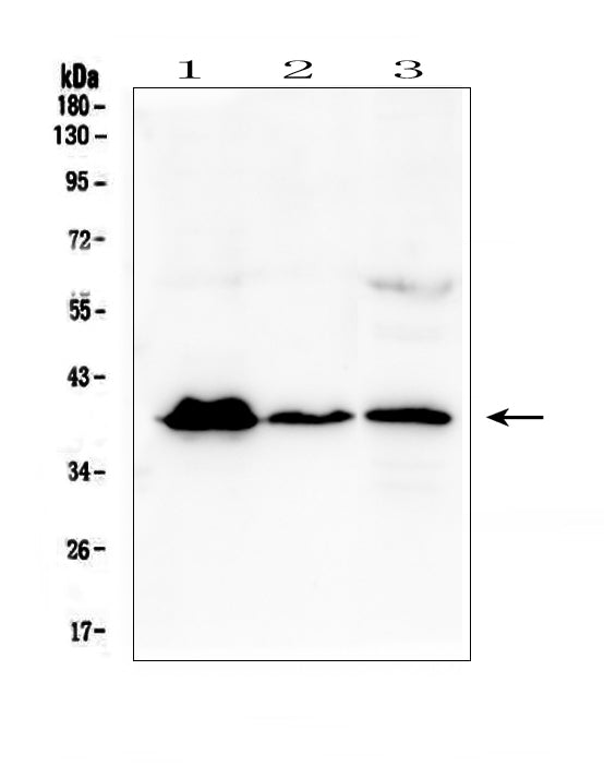 Anti-MR1 Antibody Picoband® Boster Bio