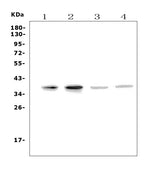 Anti-MC4-R/MC4R Antibody Picoband® Boster Bio