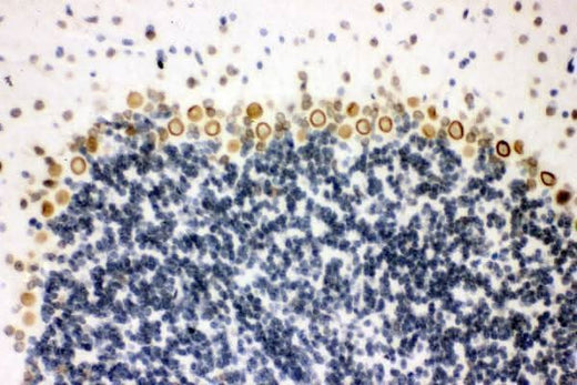 Anti-Sumo 1/SUMO1 Antibody Boster Bio