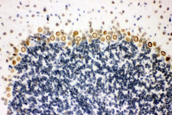 Anti-Sumo 1/SUMO1 Antibody Boster Bio
