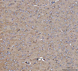 Anti-Dkk1 Antibody Boster Bio
