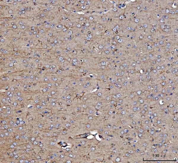 Anti-Dkk1 Antibody Boster Bio
