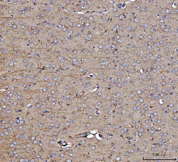 Anti-Dkk1 Antibody Boster Bio