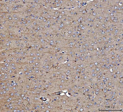 Anti-Dkk1 Antibody Boster Bio