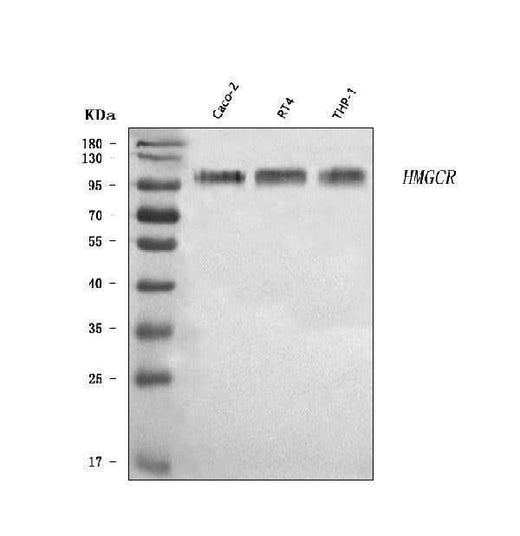 Anti-HMGCR Antibody Picoband® Boster Bio