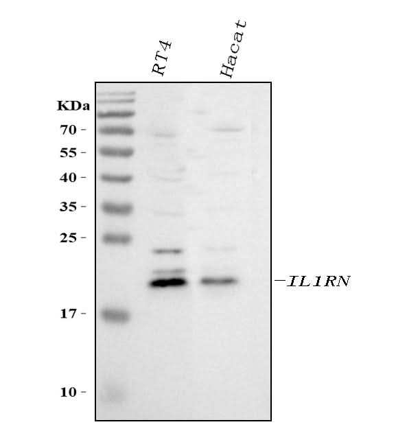 Anti-IL1RA/IL1RN Antibody Picoband® Boster Bio