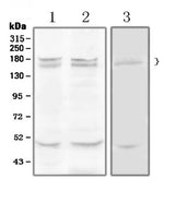 Anti-Thrombospondin/THBS1 Antibody Picoband® Boster Bio