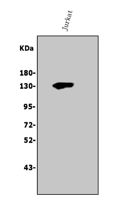 Anti-Thrombospondin/THBS1 Antibody Picoband® Boster Bio