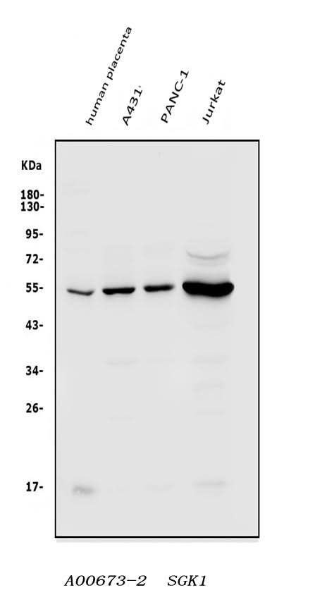 Anti-SGK1 Antibody Picoband® Boster Bio