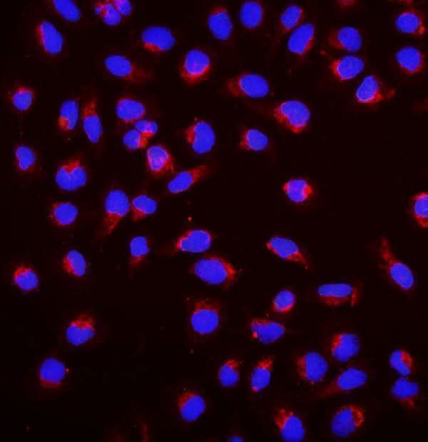 Anti-SGK1 Antibody Picoband® Boster Bio