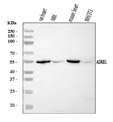 Anti-ADRB1 Antibody Picoband® Boster Bio