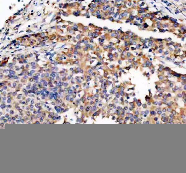 Anti-TRIO Antibody Boster Bio