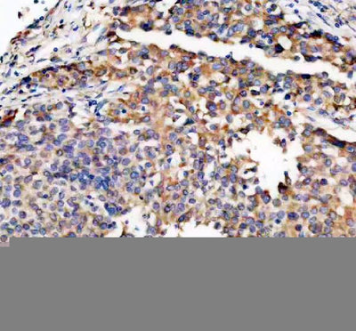 Anti-TRIO Antibody Boster Bio