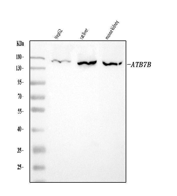 Anti-ATP7B Antibody Picoband® Boster Bio