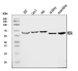 Anti-HEXA Antibody Picoband® Boster Bio