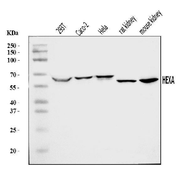 Anti-HEXA Antibody Picoband® Boster Bio