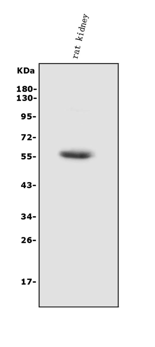 Anti-HEXA Antibody Picoband® Boster Bio