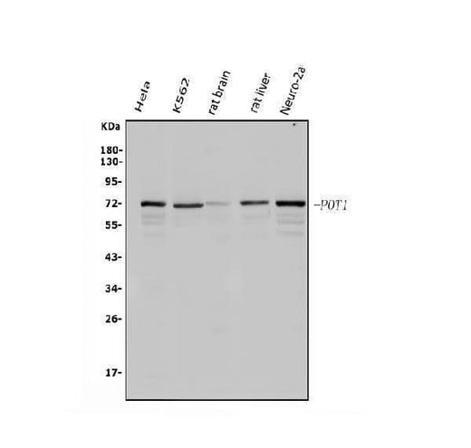 Anti-POT1 Antibody Picoband® Boster Bio