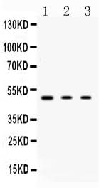 Anti-Protein Kinase A regulatory subunit I alpha/PRKAR1A Antibody Picoband® Boster Bio