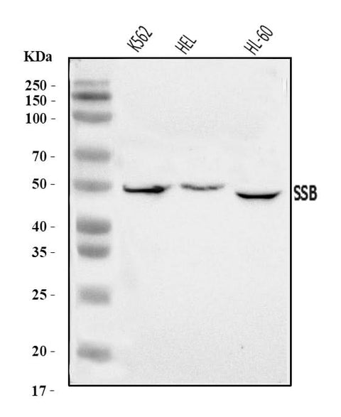Anti-SSB Antibody Picoband® Boster Bio