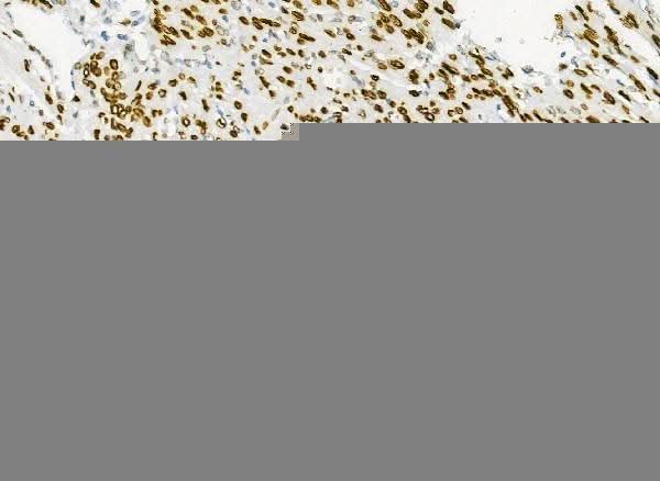 Anti-Emerin/EMD Antibody Picoband® Boster Bio