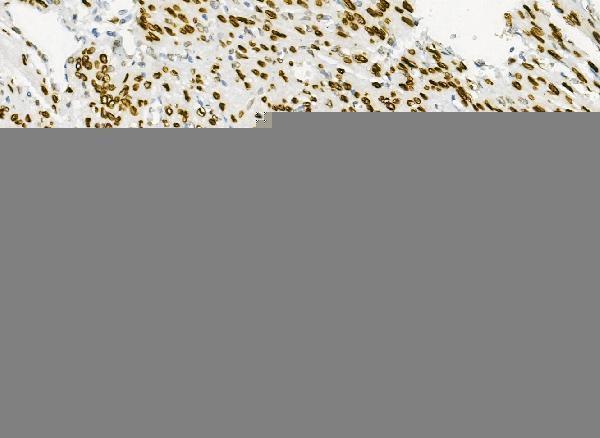 Anti-Emerin/EMD Antibody Picoband® Boster Bio