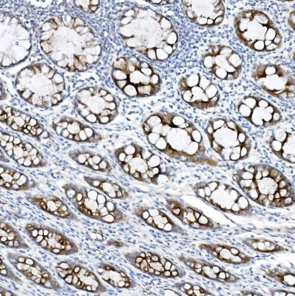 Anti-MUC5B Antibody Boster Bio