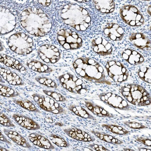 Anti-MUC5B Antibody Boster Bio