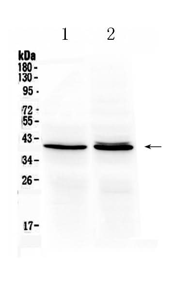 Anti-Ornithine Carbamoyltransferase/OTC Antibody Picoband® Boster Bio