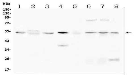 Anti-SMAD1/SMAD5 Antibody Picoband® Boster Bio