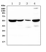 Anti-Argininosuccinate Lyase/ASL Antibody Picoband® Boster Bio