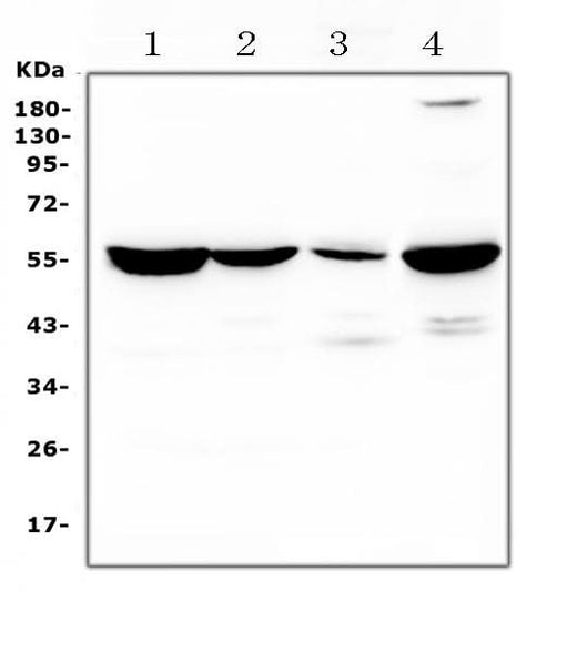 Anti-Argininosuccinate Lyase/ASL Antibody Picoband® Boster Bio