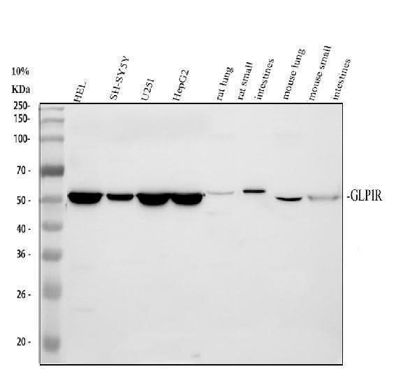 Anti-GLP1R Antibody Picoband® Boster Bio