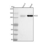 Anti-ACE2 Antibody Picoband® Boster Bio