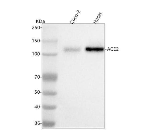 Anti-ACE2 Antibody Picoband® Boster Bio