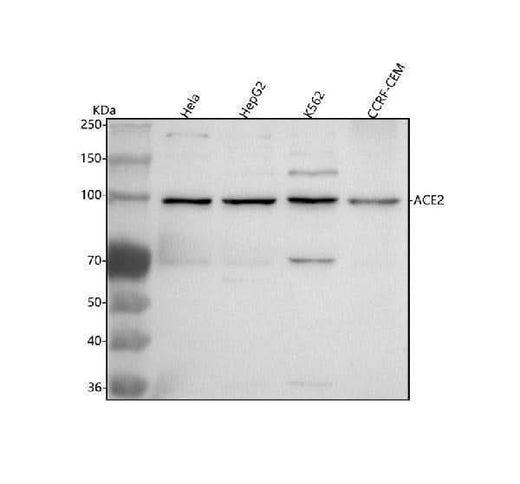 Anti-ACE2 Antibody Picoband® Boster Bio