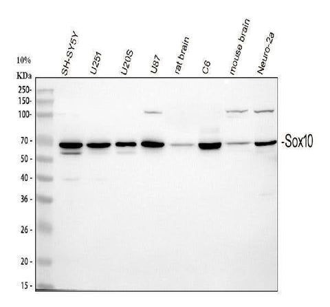 Anti-SOX10 Antibody Picoband® Boster Bio