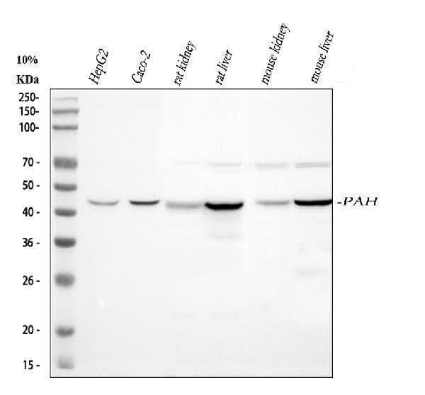 Anti-PAH Antibody Picoband® Boster Bio