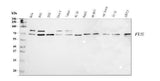 Anti-TLS/FUS Antibody Picoband® Boster Bio