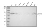 Anti-Estrogen Receptor beta/ESR2 Antibody Picoband® Boster Bio