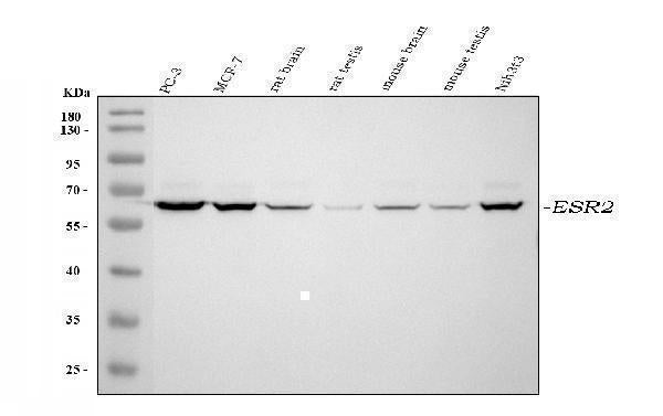 Anti-Estrogen Receptor beta/ESR2 Antibody Picoband® Boster Bio