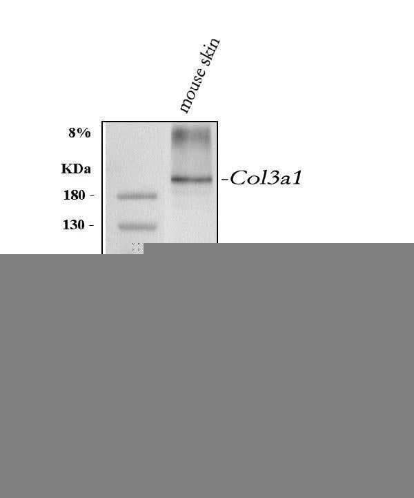 Anti-Collagen III/COL3A1 Antibody Picoband® Boster Bio