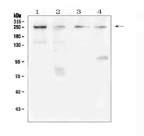 Anti-TRPM7 Antibody Picoband® Boster Bio