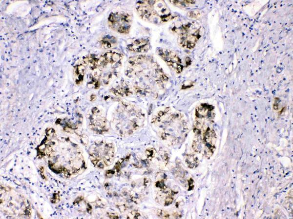 Anti-Fibrinogen gamma chain/FGG Antibody Picoband® Boster Bio