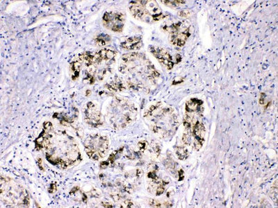 Anti-Fibrinogen gamma chain/FGG Antibody Picoband® Boster Bio