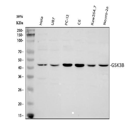 Anti-GSK3 beta/GSK3B Antibody Picoband® Boster Bio